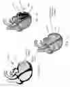 Fig. 02 - Method and devices for treating ischemic congestive heart failure