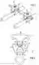 Fig. 02 - Connection system between a spinal rod and a transverse bar