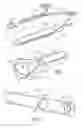 Fig. 02 - Method of securing vertebrae
