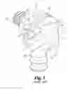 Fig. 02 - Variable angle spinal implant connection assembly