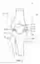 Fig. 02 - Method and apparatus for less invasive knee resection