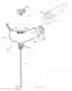 Fig. 07 - Remotely actuated system for bone cement delivery