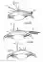 Fig. 07 - System for packaging and handling an implant and method of use
