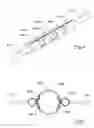 Fig. 05 - Self-orienting polypectomy snare device