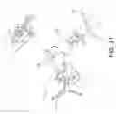 Fig. 32 - Surgical navigation systems and processes for unicompartmental knee arthroplasty