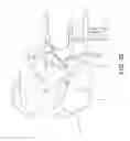 Fig. 33 - Surgical navigation systems and processes for unicompartmental knee arthroplasty