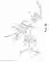 Fig. 37 - Surgical navigation systems and processes for unicompartmental knee arthroplasty