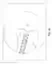 Fig. 43 - Surgical navigation systems and processes for unicompartmental knee arthroplasty