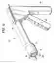 Fig. 02 - Cervical conization device