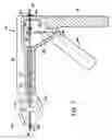Fig. 09 - Cervical conization device
