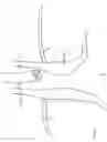 Fig. 08 - Surgical implant