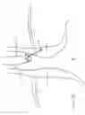 Fig. 22 - Surgical implant