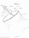 Fig. 04 - Trans-septal sheath with splitting dilating needle and method for its use