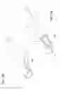 Fig. 07 - Self-activating endoluminal device