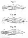 Fig. 06 - Intravascular filter and method