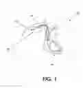 Fig. 02 - Device and method for preventing magnetic-resonance imaging induced damage