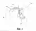Fig. 02 - Device and method for preventing magnetic-resonance imaging induced damage