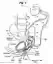 Fig. 02 - Method, system and device for treating various disorders of the pelvic floor by electrical stimulation of the pudendal nerves and the sacral nerves at different sites