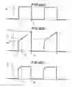 Fig. 07 - Gastric stimulator apparatus and method for use