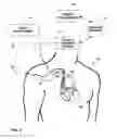 Fig. 02 - Patient notification of medical device telemetry session