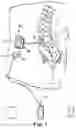 Fig. 02 - Method of charging an implantable medical device