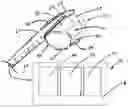 Fig. 01 - Surgical tool with an electroactive polymer for use in a body