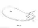 Fig. 04 - Medical device and method of manufacturing