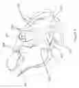 Fig. 03 - Implantable lead including sensor