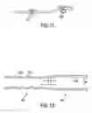 Fig. 07 - Composite stent with inner and outer stent elements and method of using the same
