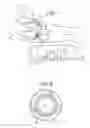 Fig. 02 - Method and apparatus for preventing dialysis graft intimal hyperplasia