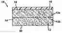 Application 20050113938, fig. 01