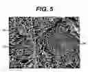 Fig. 04 - Method of preparation of bioabsorbable porous reinforced tissue implants and implants thereof