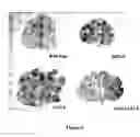 Fig. 07 - Expression of foreign sequences in plants using transactivation system