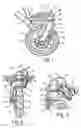 Fig. 02 - Infant pushchair wheel support