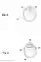 Fig. 04 - Method and device for fastening a sensor