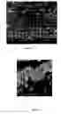 Fig. 08 - High temperature strain gages