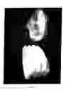 Fig. 06 - Device for reducing the volume of bottle made of plastic material