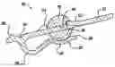 Fig. 01 - Method of providing shaft biasing lubrication for a short runner valve shaft