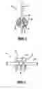 Fig. 02 - Method of providing shaft biasing lubrication for a short runner valve shaft