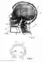 Fig. 02 - Device for supporting the cervical vertebral column
