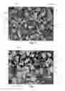 Fig. 04 - High Volume Density Polycrystalline Diamond With Working Surfaces Depleted Of Catalyzing Material