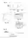 Fig. 05 - High Volume Density Polycrystalline Diamond With Working Surfaces Depleted Of Catalyzing Material