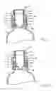 Fig. 06 - Cap device for mixing different kinds of materials separately contained therein and in bottle