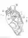 Fig. 07 - Apparatus and method for accommodating part mismatch during joining