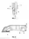 Fig. 05 - Surgical stapler with removable staple cartridge