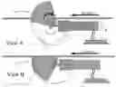 Fig. 01 - Dragless flight control system for flying objects