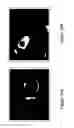 Fig. 34 - Methods and devices for concentration and purification of analytes for chemical analysis including matrix-assisted laser desorption/ionization(MALDI) mass spectrometry (MS)