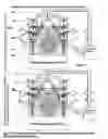 Fig. 03 - Turbine generator vibration damper system