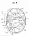 Fig. 09 - Insert molded end bell for a submersible motor and method of manufacture thereof