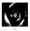 Fig. 09 - Dynamic crop box determination for optimized display of a tube-like structure in endoscopic view (